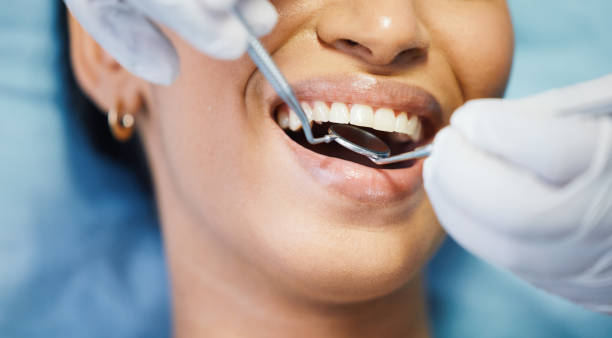 Best Emergency Denture Repair in Warrensburg, MO